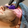 Image 2: Get Glowing Skin with 1 or 6 Sessions of Carbon Laser Peel Facial at Agatha K Micropigmentation (Up to 48% Off)