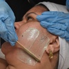 Image 2: Up to 25% Off on  at Rennova Aesthetic Clinic