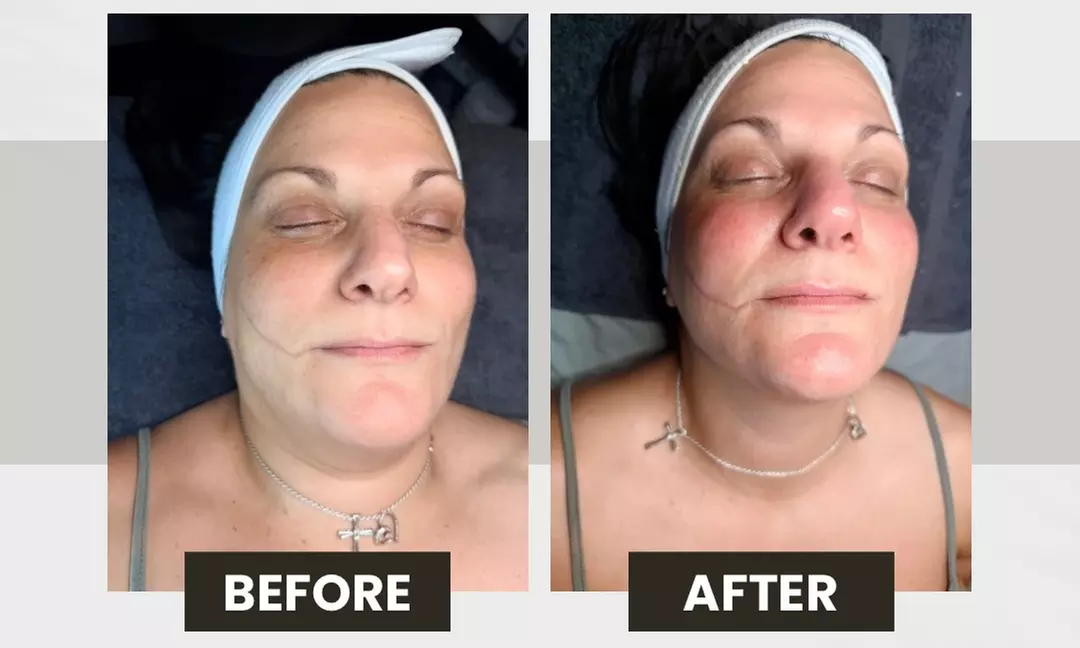 Reveal Your Most Luminous Self: The Diamond Glow Experience