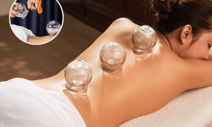 Image 5: Experience HealthKey MedSpa Clubs with diverse acupuncture options for relaxation and rejuvenation, up to 63% off