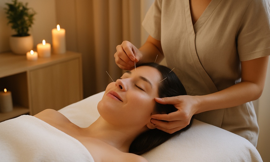 Image 3: Up to 55% Off on Cupping at Point Power Acupuncture and Wellness