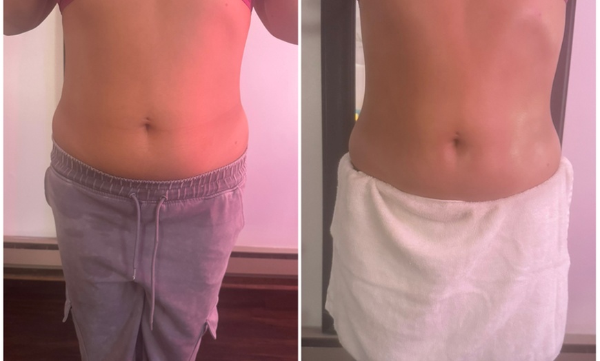 Image 5: Up to 61% Off on Ultrasonic Fat Reduction at Travel Goddess Bodies