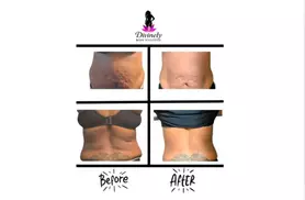 semaglutide weight loss kansas city & Overland Park Semaglutide Weight Loss Injections -