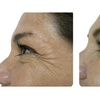Image 4: Refresh Yourself with Xeomin Shots