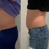 Image 1: Up to 61% Off on Ultrasonic Fat Reduction at ILLUME Skin Spa