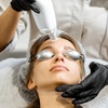Image 7: Microneedling with Laser Resurfacing for the Hands, Lower Eyes, Neck, or Full Face at Loma Laser (Up to 47% Off)
