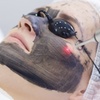 Image 1: IPL, Carbon Laser, RF Lifting or Micro-needling Facial Sessions