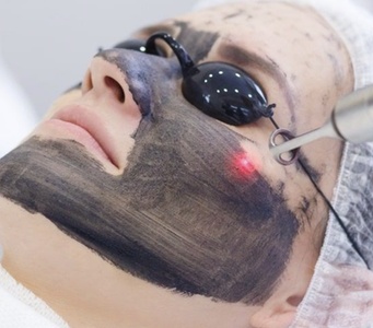 1 session of a microdermabrasion facial with a facial mask-NEW customer only - Axon aesthetics
