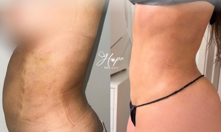 1 Post-op Massage  (60 Min) - Hope 360 Post