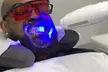 30- or 60-Min Express or 60-Min In-Office Teeth Whitening with Optional High-Power Booster - Second Medium
