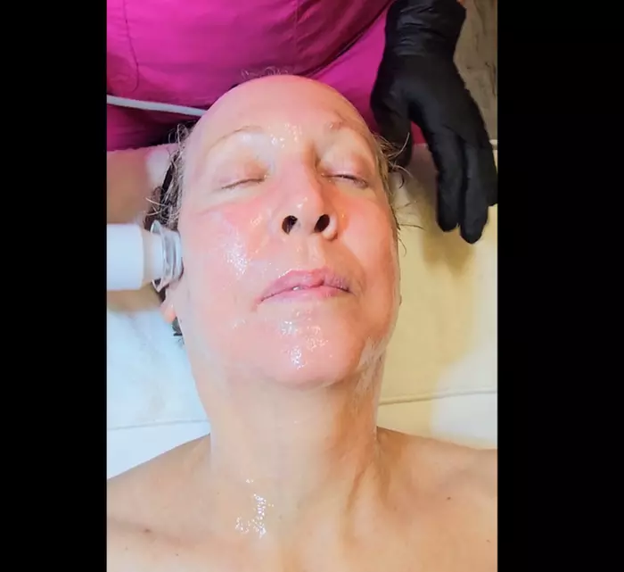 Up to 40% Off Derm-Glow Facial or Facial + Insta-Lift Mask