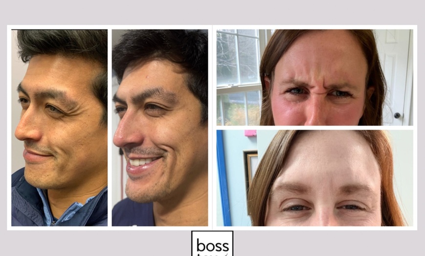 Image 3: Refresh Your Look with 10, 20, or 30 Units of Xeomin/Jeuveau