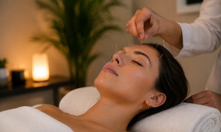 45-Minute Acupuncture Session - Kangfulin Naturopathy Center