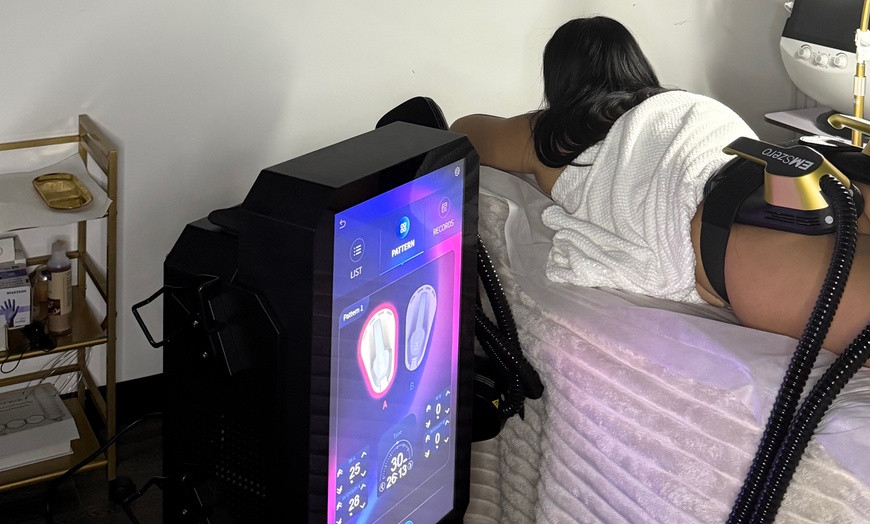Image 4: Transform Your Body with EMS Zero One or Four Sessions!