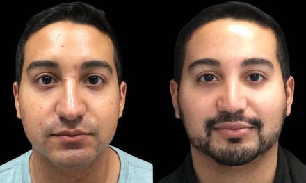 One HydraFacial Signature Treatment - S Beauty Salon
