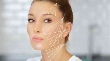 PDO Threads Fox Eye Lift - DermaLux Aesthetics