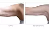 Up to 54% Off on Radio Frequency Skin Tightening at Beauty Factory Boutique Spa