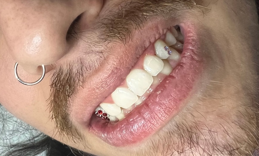 Image 3: Sparkle up with One or Two Tooth Gems for a Bright Smile