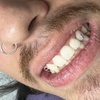 Image 3: Sparkle up with One or Two Tooth Gems for a Bright Smile