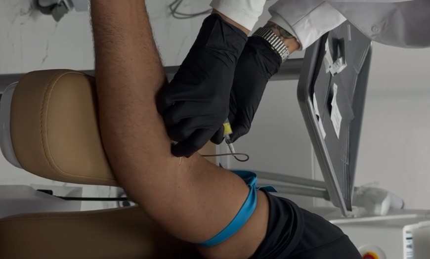 Image 6: Up to 64% Off on Hair Restoration - Non-Surgical at Estetika Med Spa