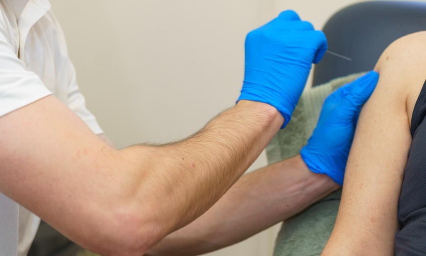 Image 3: 1 Hour Acupuncture Appointment with Consultation and Treatment 