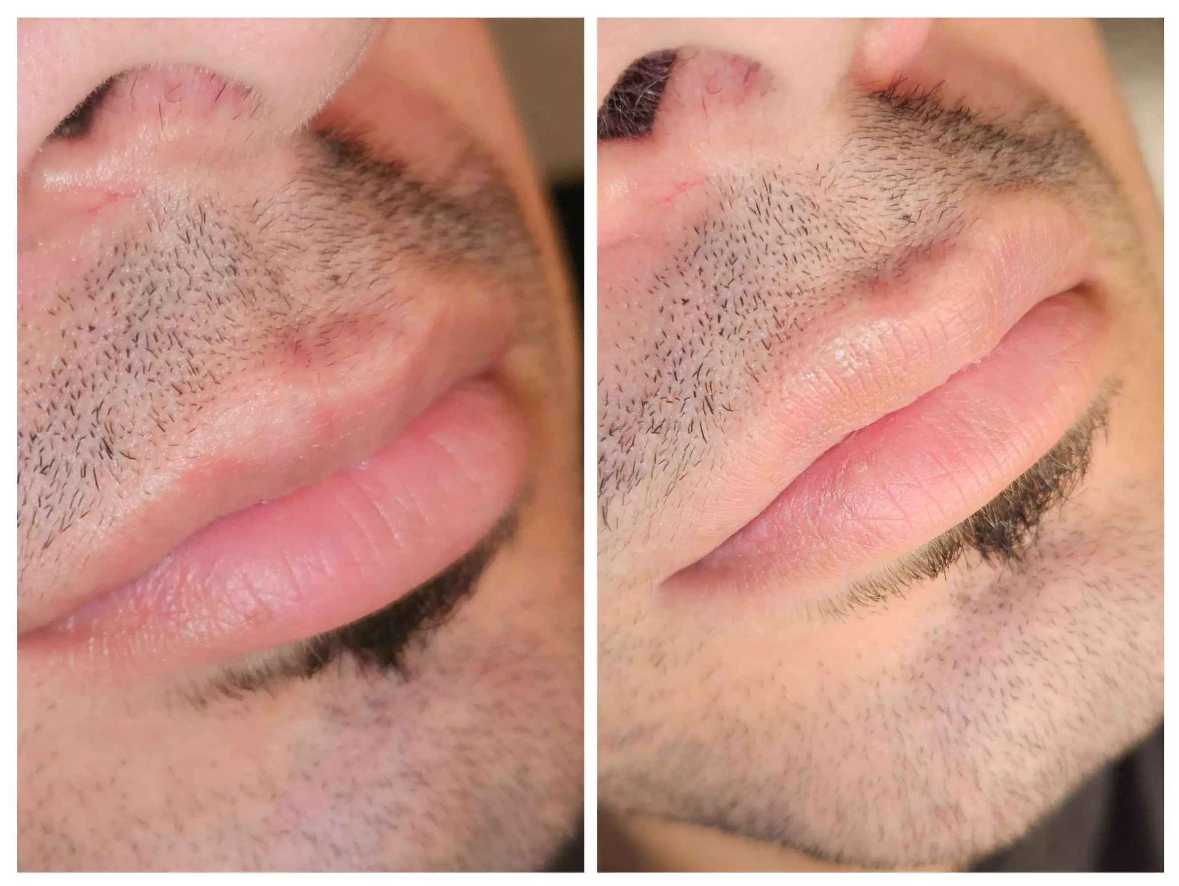 Explore Permanent Lip Color