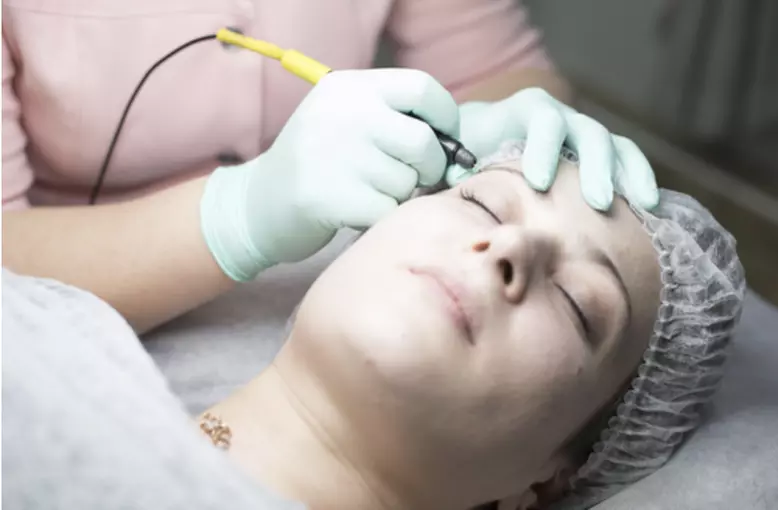 Get Smooth Skin with a 30-minute Electrolysis Session