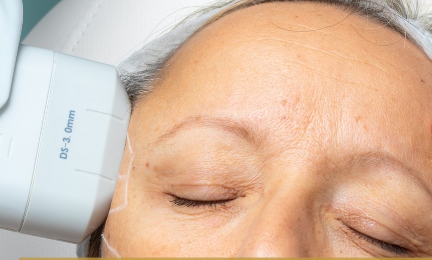 Image 7: Tratamiento HIFU avanzado para tensado facial y corporal no invasivo
