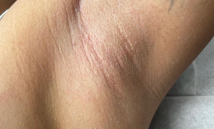 Image 3: Smooth Skin with Both Legs, Underarm, Full Face, or Bikini Wax Service