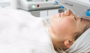 12D HIFU Facelift for Face/Neck with Oxygen Therapy and LED Mask – Up to 76% Off