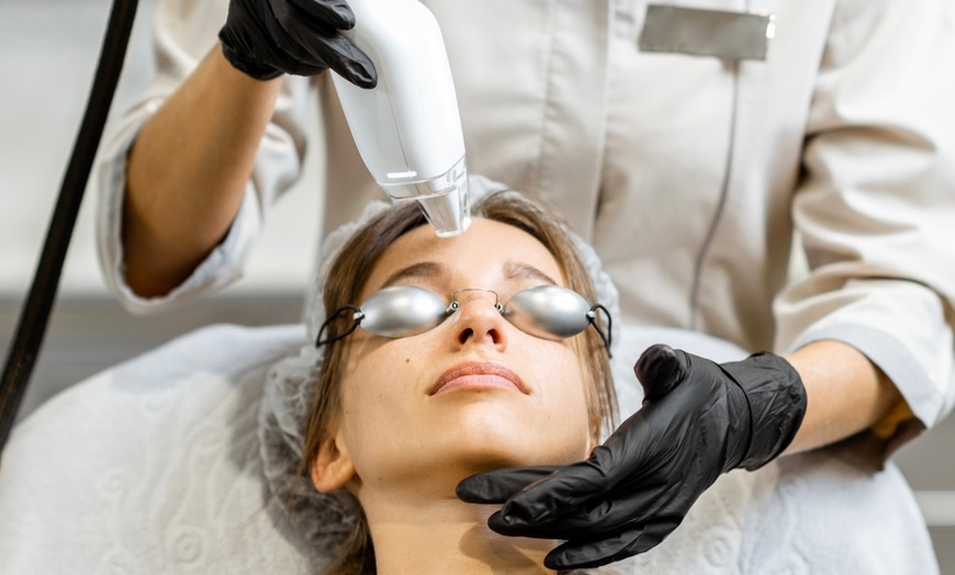 Image 1: Non-Ablative Fractional Laser - LaseMD Ultra for Stretch Marks, Face, Neck, or Hands at Loma Laser (Up to  45% Off)