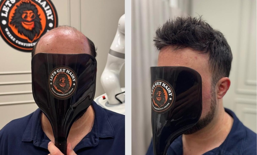 Image 1: 1 Non-Surgical Hair Replace System w/ Optional Maintenance Follow Up