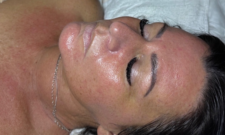 Image 3: Up to 53% Off on Microdermabrasion at Face Forward Esthetics