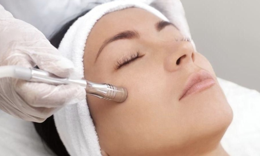Image 3: IPL, Carbon Laser, RF Lifting or Micro-needling Facial Sessions