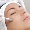Image 3: IPL, Carbon Laser, RF Lifting or Micro-needling Facial Sessions