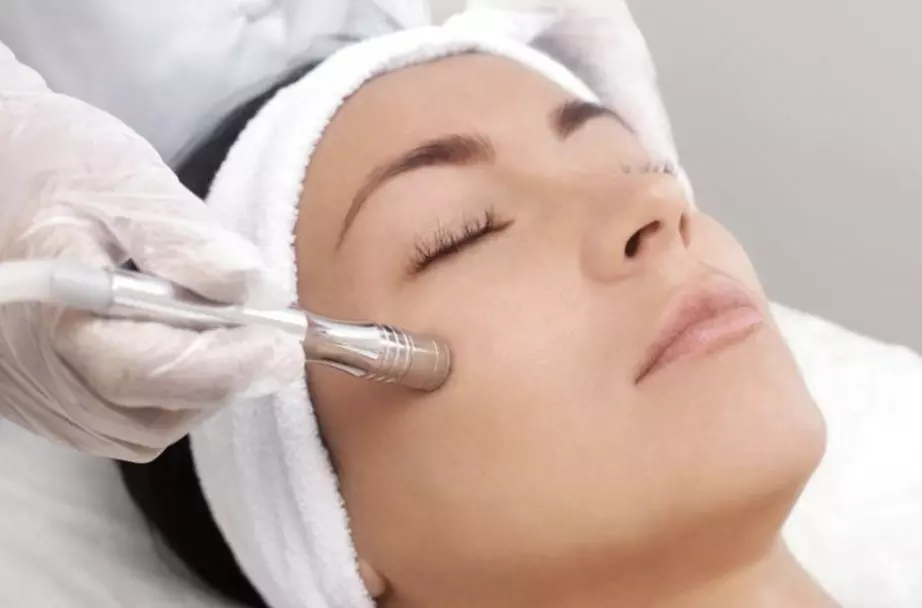 IPL, Carbon Laser, RF Lifting or Micro-needling Facial Sessions