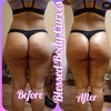 Image 1: Up to 84% Off on Lipo - Non-Invasive Laser-iLipo at Blessed Body Curves
