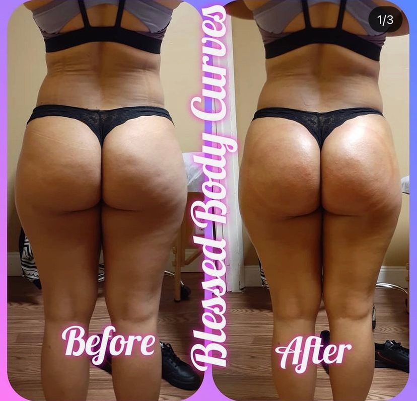 Up to 84% Off on Lipo - Non-Invasive Laser-iLipo at Blessed Body Curves