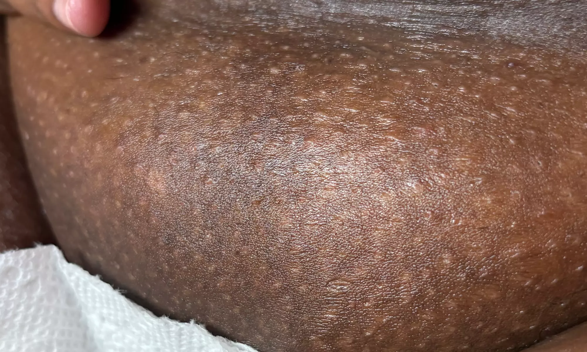 Up to 52% Off on Brazilian / Bikini Waxing at Sknoncler - Primary Image