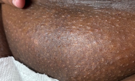 1 Brazilian Wax - Sknoncler