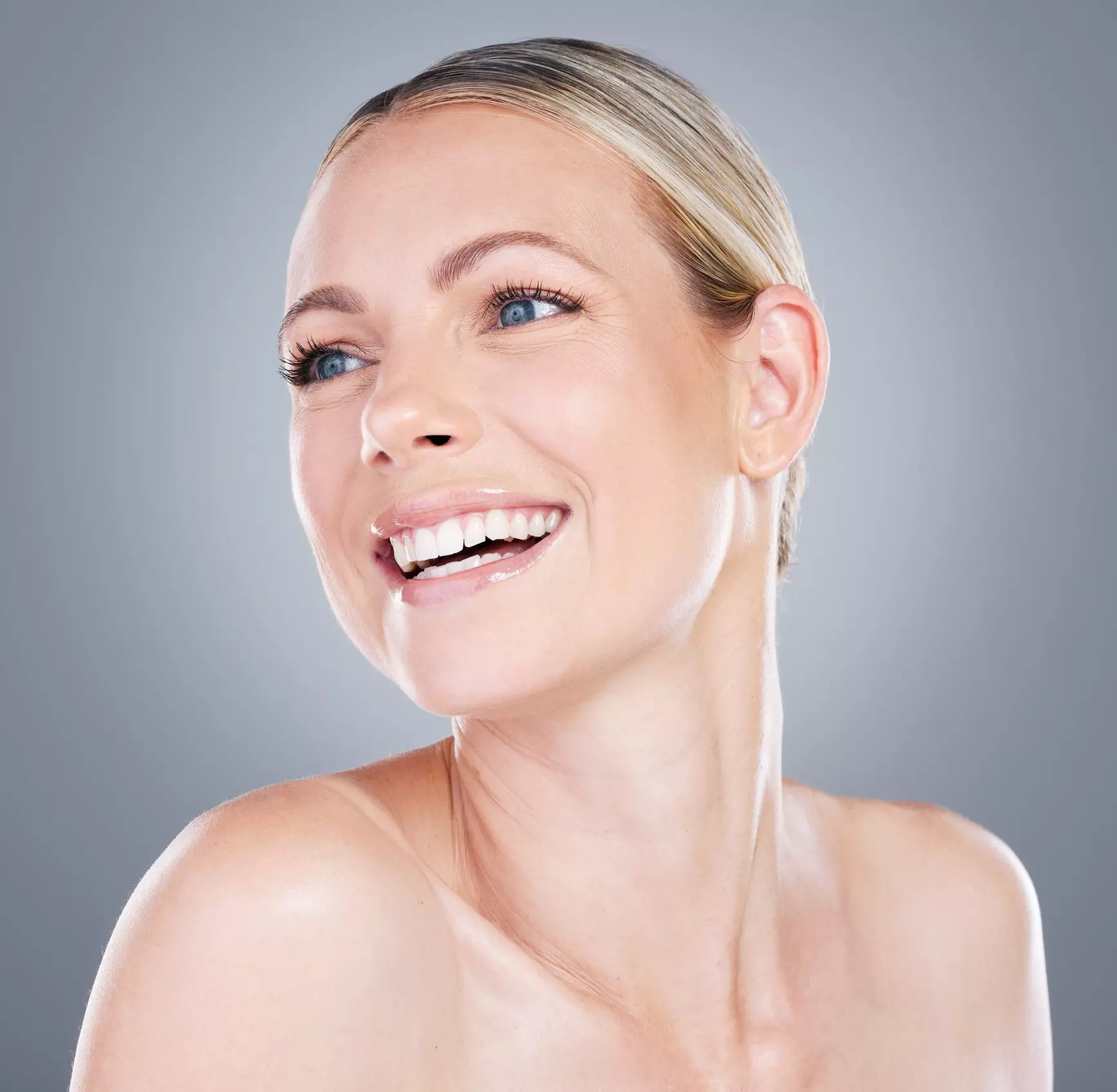 Smooth Wrinkles with 20, 40, or 60 Units of Xeomin