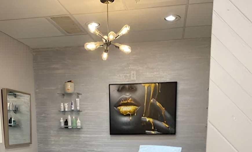 Image 4: Enhance Your Beauty: 20 Units of Botox with Optional Lip Flip