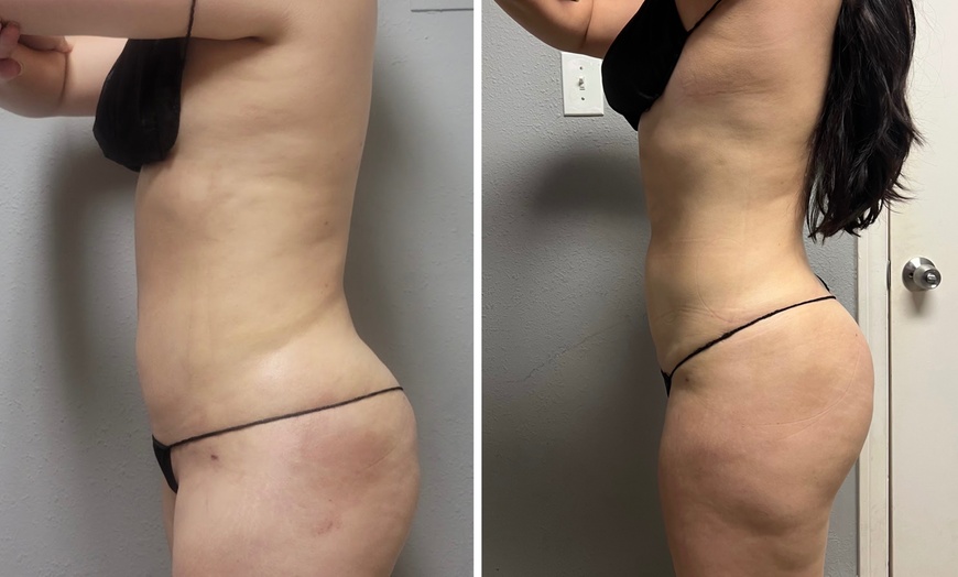 Image 7: 60-Min Lymphatic Drainage: Post-Op, Wellness, or Face/Chin Recovery
