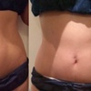 Image 2: Up to 50% Off on Cavitation at Leveyna