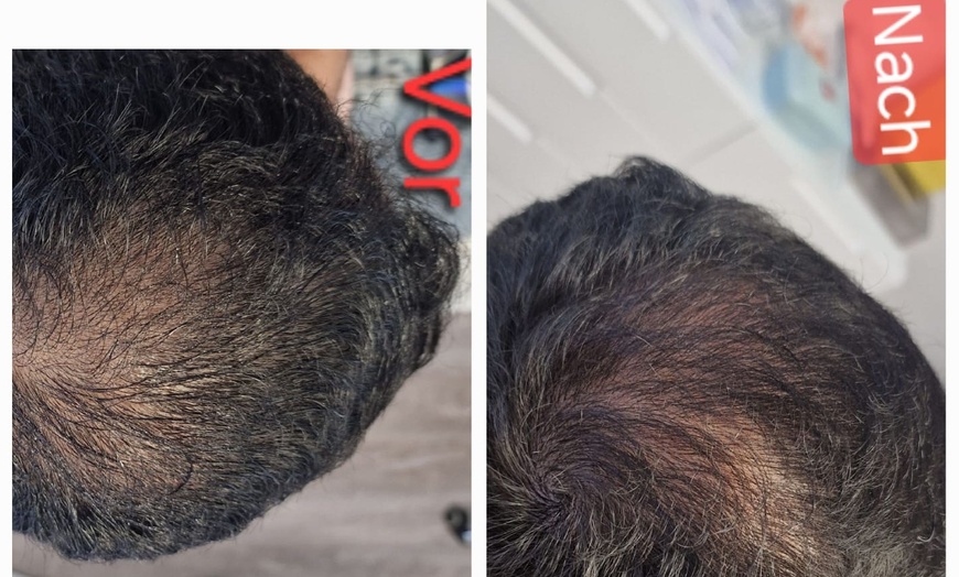 Image 7: Bis zu 4% Rabatt auf den Schönheitspaket bei PRIVATPRAXIS Nataliya Katsarova