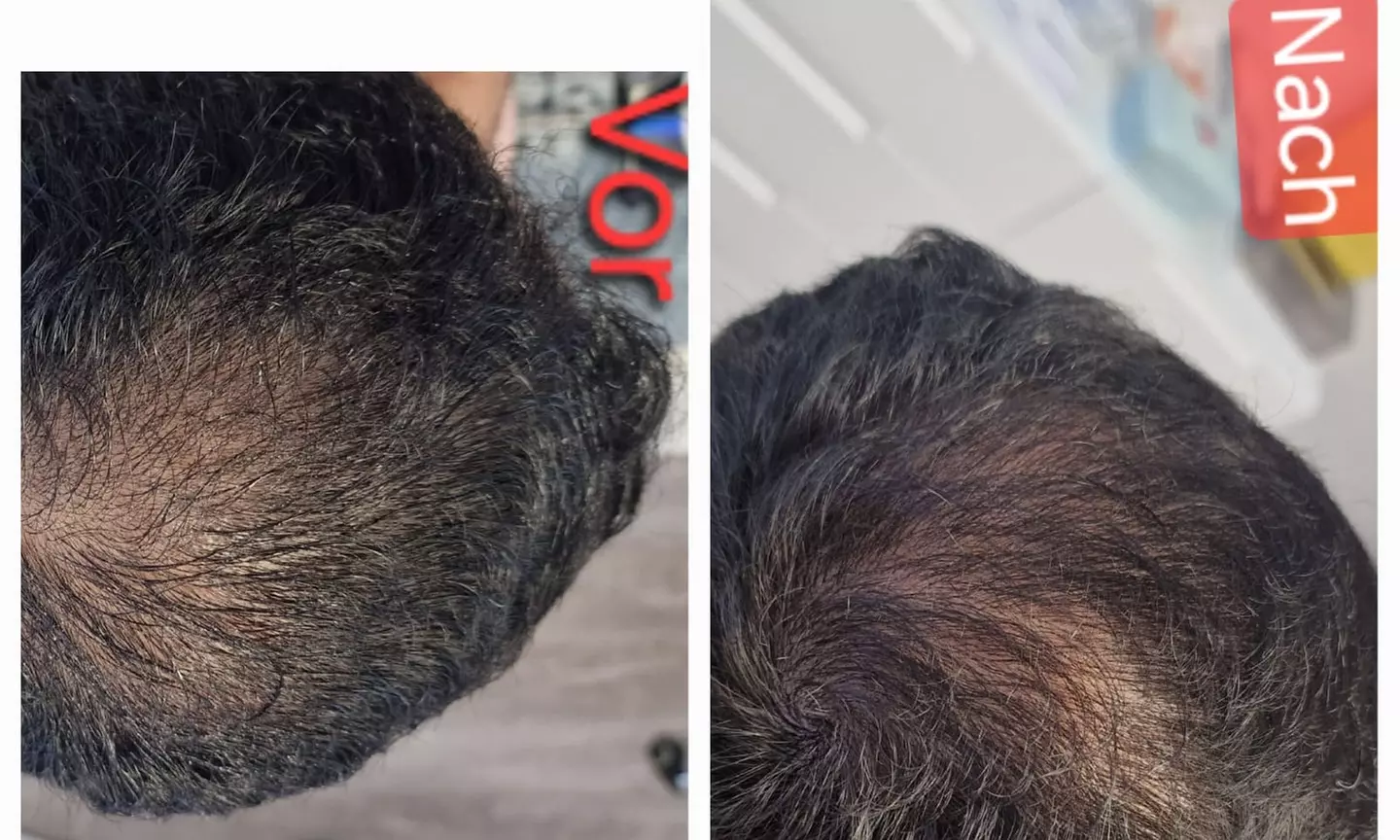 Bis zu 4% Rabatt auf den Schönheitspaket bei PRIVATPRAXIS Nataliya Katsarova