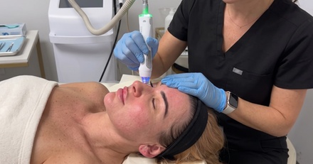 One RF Skin Tightening Treatment for the Face/Neck - Highline Aesthetics