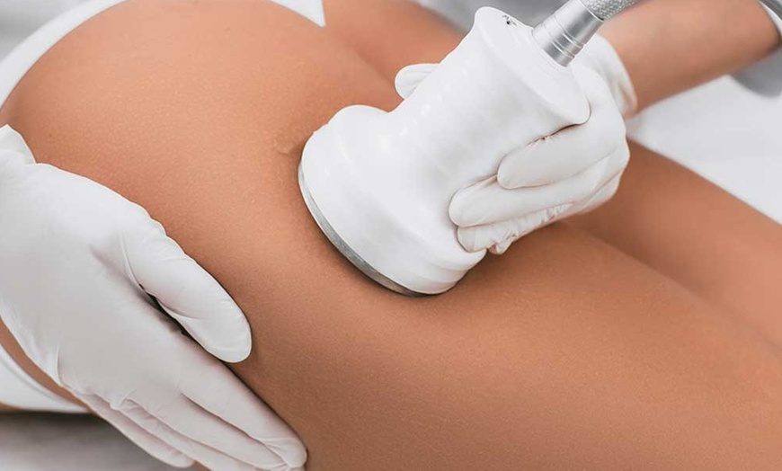 Image 9: Up to 58% Off on Radio Frequency Skin Tightening at UK Aesthetics Lounge