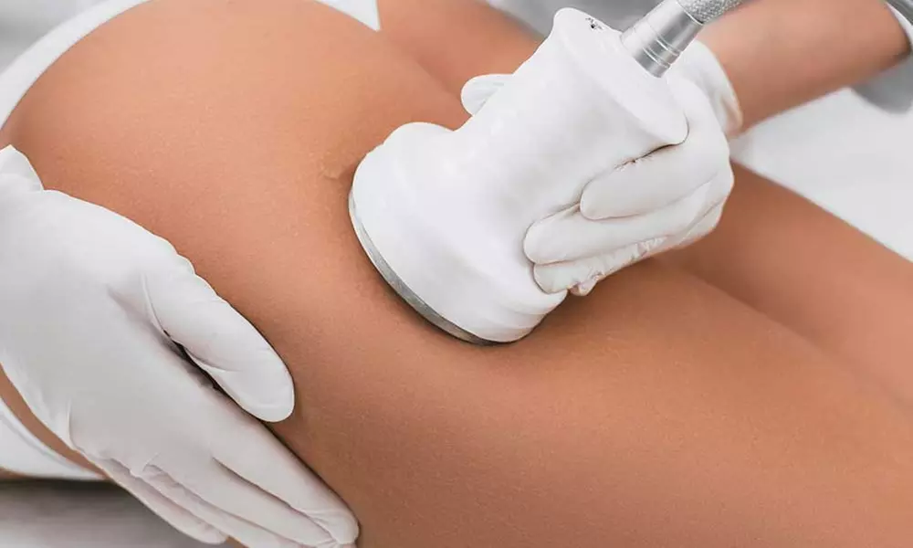 Up to 65% Off on Radio Frequency Skin Tightening at UK Aesthetics Lounge