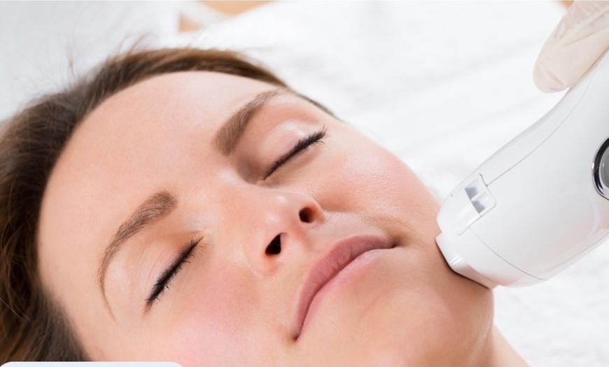 Image 3: Hydradermabrasion with Salmon DNA or Blue Copper + Oxygen & LED